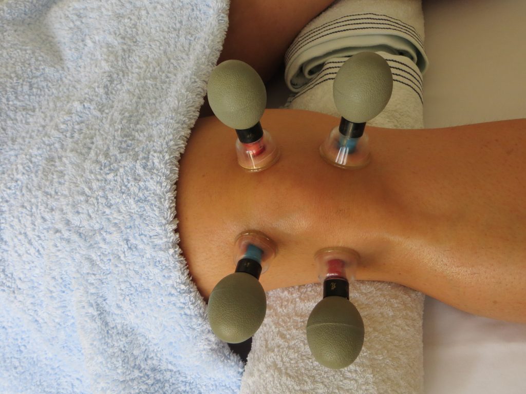 Magnetic Cupping Therapy
