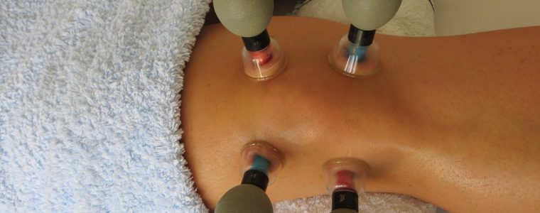 Magnetic Cupping Therapy